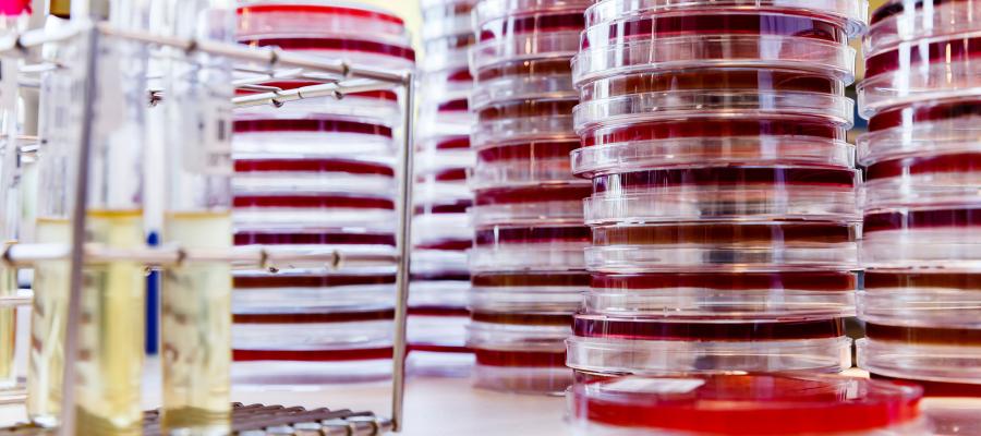 Infektiöse Gastroenteritis Medics